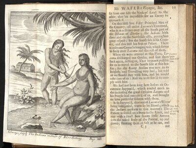 A New Voyage and Description of the Isthmus of America  - The Indians maner of Bloodletting.