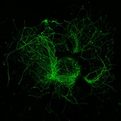 Whirlwind of neurites extending from fluorescent neurons in cultured explants of embryonic mouse brain tissue